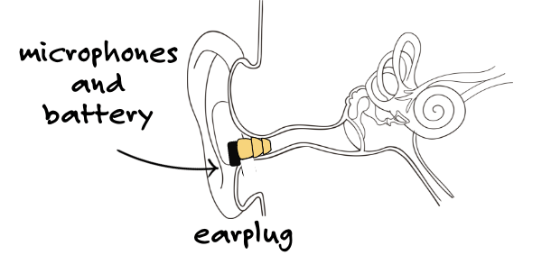 Electronic earplug cut away